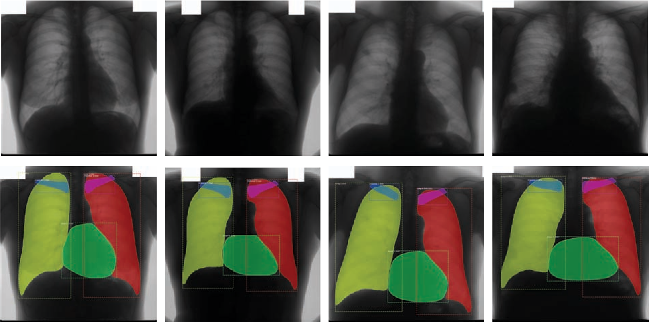 chest-xray-panoptic-segmentation