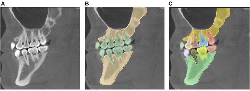 dental-segmentation